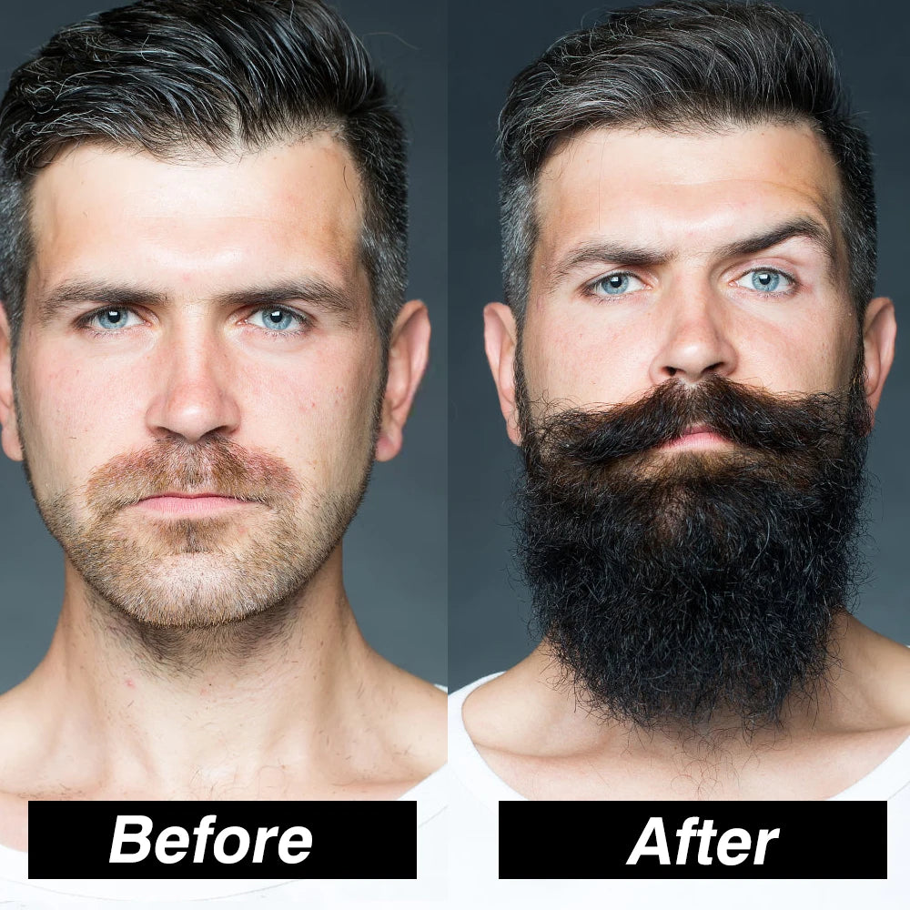 4pcs/Set Beard Growth Oil For Men Beard Growth Serum Roller Comb Kit