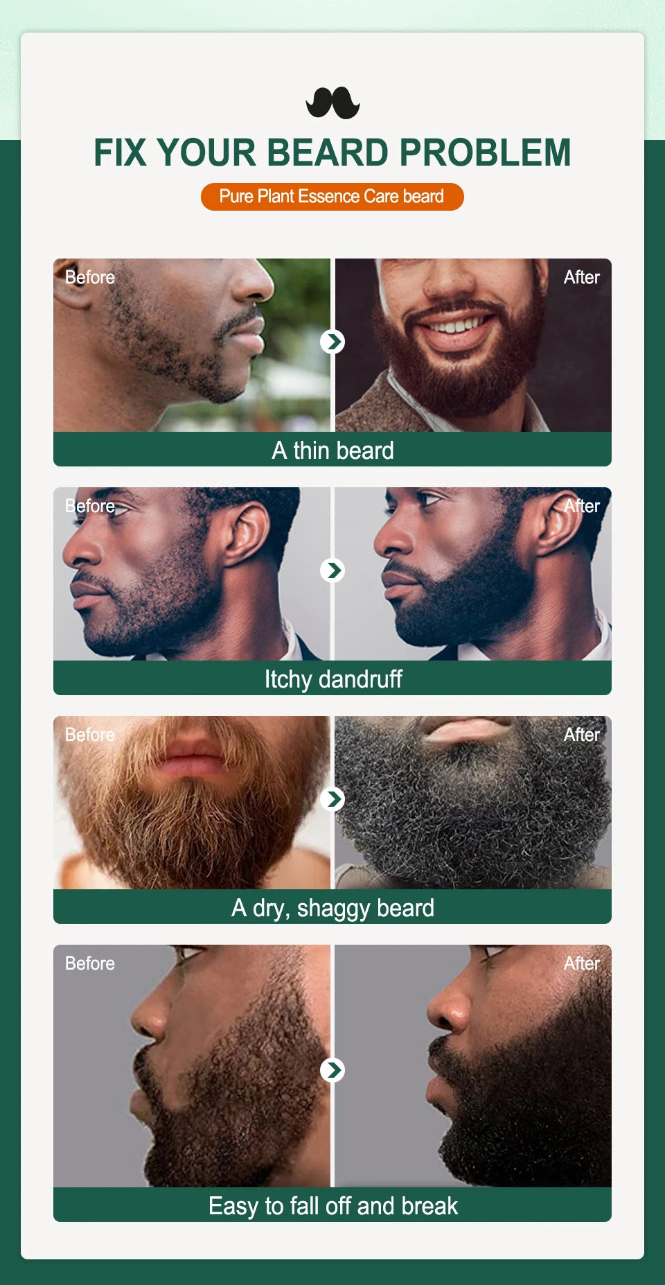 Men Biotin Beard Oil Natural Tea Tree Nourishing Regrowth Oil